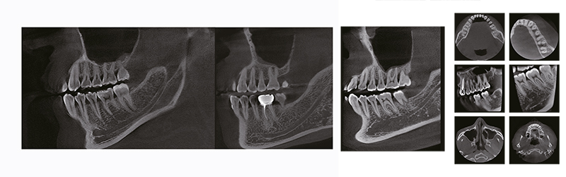 RAYSCAN Alpha+ 160 (1)-4.jpg