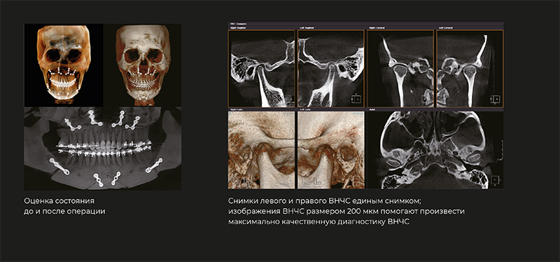 RAYSCAN Alpha+ 3D (1)-4.jpg