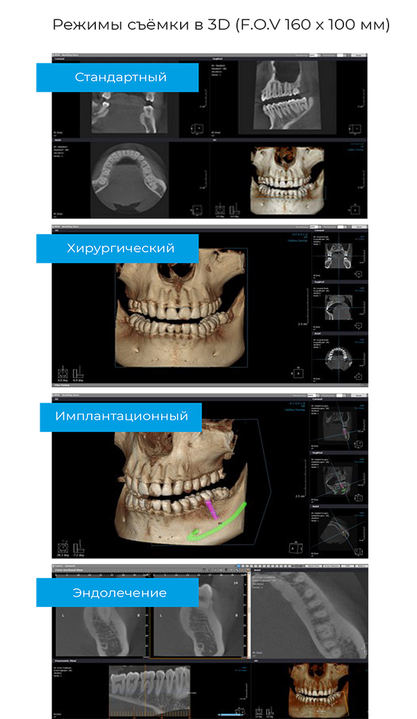 RAYSCAN Alpha+ 160 (1)-18-2.jpg