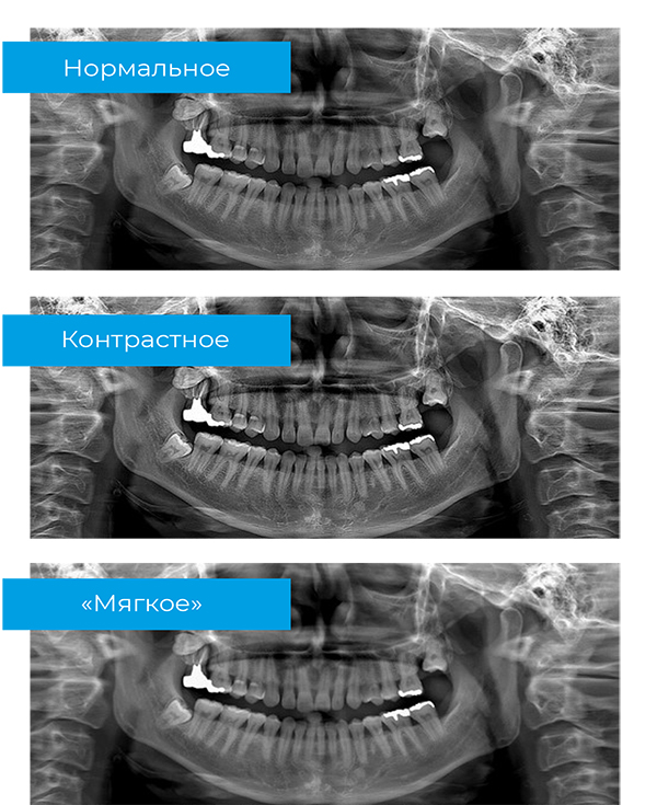 RAYSCAN Alpha+ 160 (1)-18.jpg