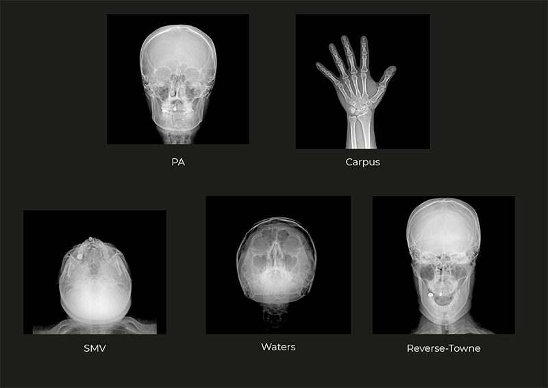 RAYSCAN Alpha+ 3D (1)-7.jpg