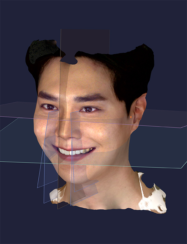 RAYSCAN Alpha+ 160 (1)-15-2.jpg