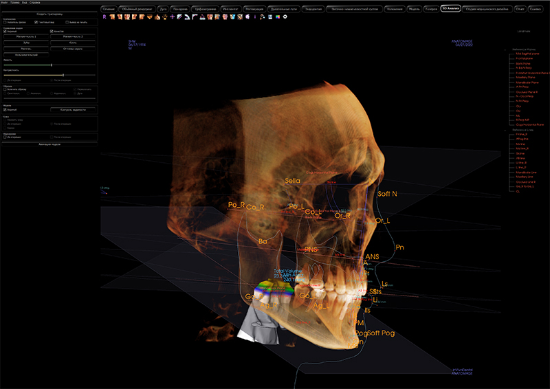 RAYSCAN Alpha+ 3D (1)-13.jpg