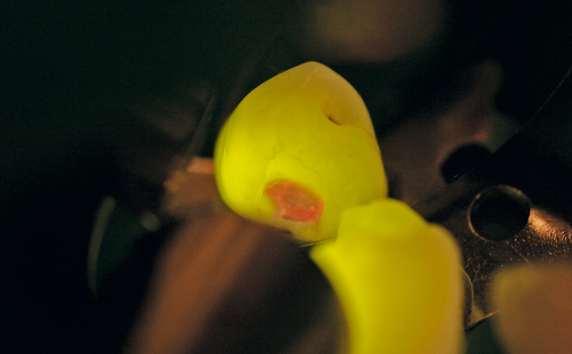 SIROInspect - ультрафиолетовый кариес-детектор 6.jpg SIROInspect - ультрафиолетовый кариес-детектор 6.jpg