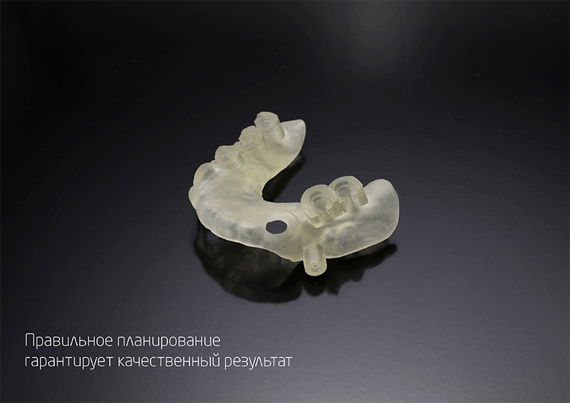 RAYSCAN Alpha+ 3D (1)-10.jpg