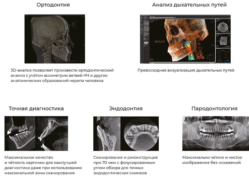 RAYSCAN Alpha+ 3D (1)-5.jpg