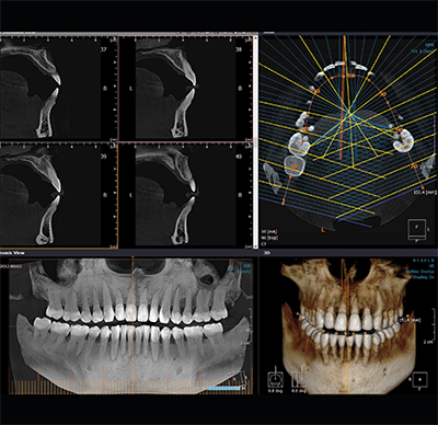 RAYSCAN Alpha+ 160 (1)-22.jpg