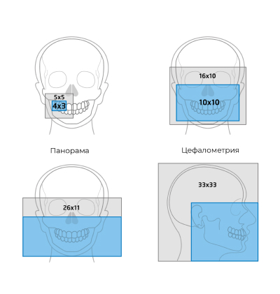 Сверхбыстрая реконструкция-1.jpg