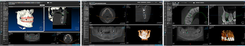 RAYSCAN Alpha+ 160 (1)-25.jpg