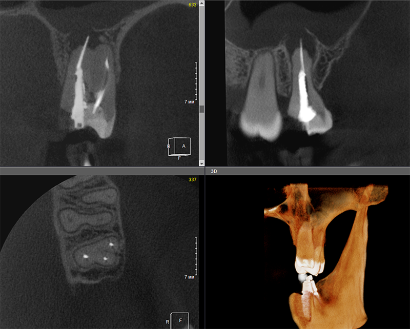 пациент 3.PNG