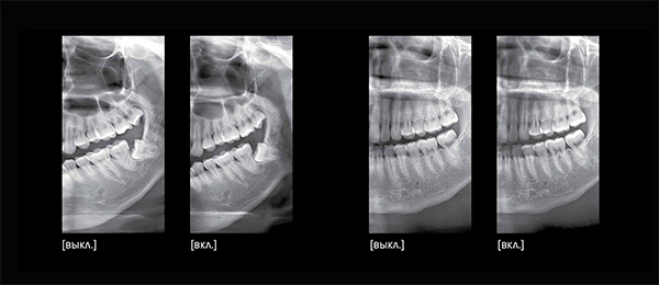 RAYSCAN Alpha+ 160 (1)-19.jpg