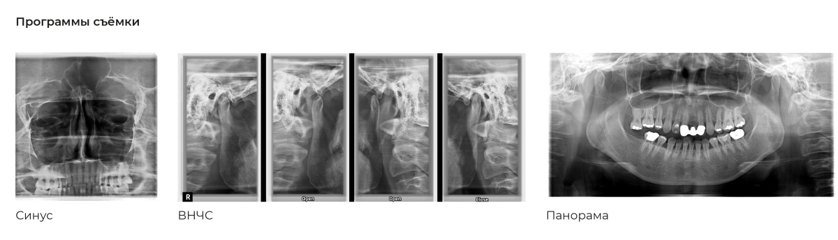 RAYSCAN-Alpha_-160-_1_17_Монтажная область 1.jpg