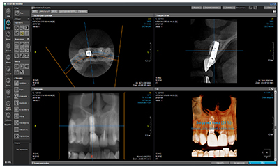 RAYSCAN Alpha+ 160 (1)-23.jpg