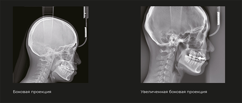 RAYSCAN Alpha+ 3D (1)-6.jpg