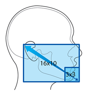 RAYSCAN Alpha+ 160 (1)-22-2.jpg
