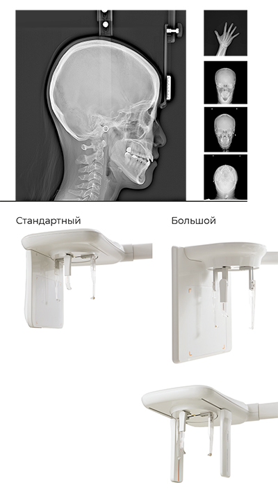 RAYSCAN Alpha+ 160 (1)-10.jpg
