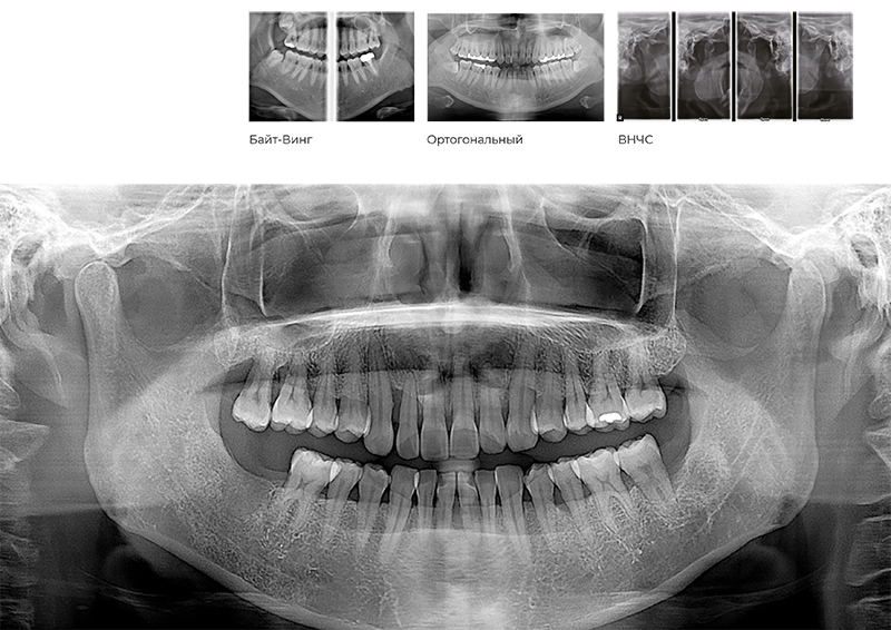 RAYSCAN Alpha+ 160 (1)-9.jpg