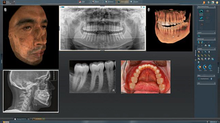 Sirona Orthophos SL 3D (11x10) – Дентальный томограф