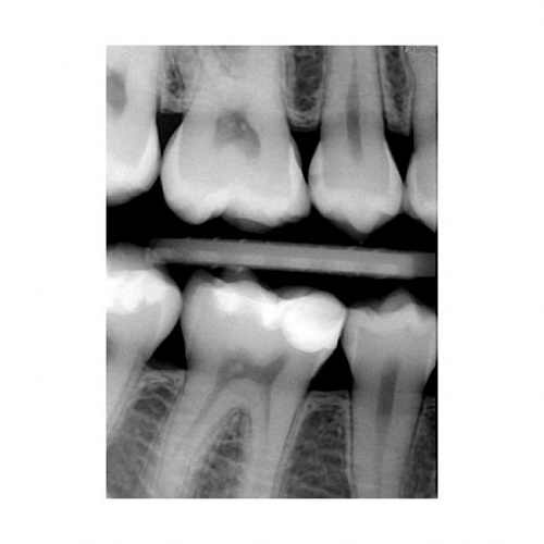 Suni SuniRay2 - система компьютерной радиовизиографии