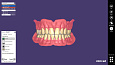 Exocad Full Denture Module - модуль полносъемных протезов