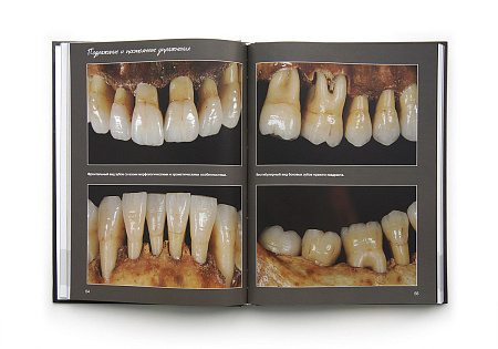 Эстетические стратегии в стоматологии. Искусство, наука и технологии. Стефано Инглезе