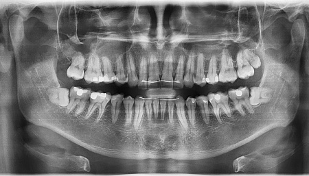Sirona Orthophos XG 3 DS – Ортопантомограф
