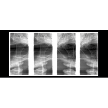 Planmeca ProOne - универсальный цифровой ортопантомограф