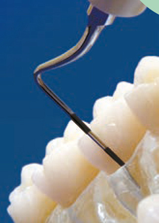 Acteon насадка для скайлера TK1-1L – длинный зонд, для осмотра и чистки средних и глубоких карманов (более 4 мм), (пародонт)