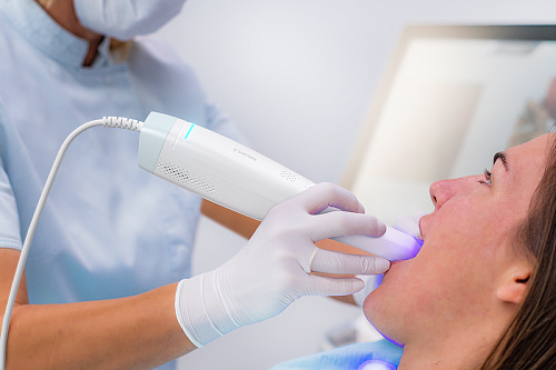 Ray RAYiOS 2 – Стоматологический интраоральный 3D-сканер