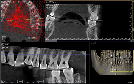 Owandy I-Max Touch 3D Ceph – Конусно-лучевой томограф 9х8