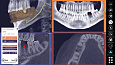 Exocad DICOM viewer - средство просмотра DICOM файлов
