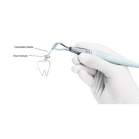 Velopex Наконечник - подходит для AquaCare